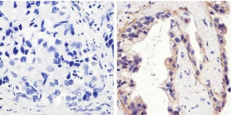 Immunohistochemistry (Formalin/PFA-fixed paraffin-embedded sections) - Anti-EGFR (phospho Y1173) antibody (AB5652)
