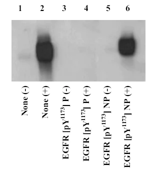 Western blot - Anti-EGFR (phospho Y1173) antibody (AB5652)