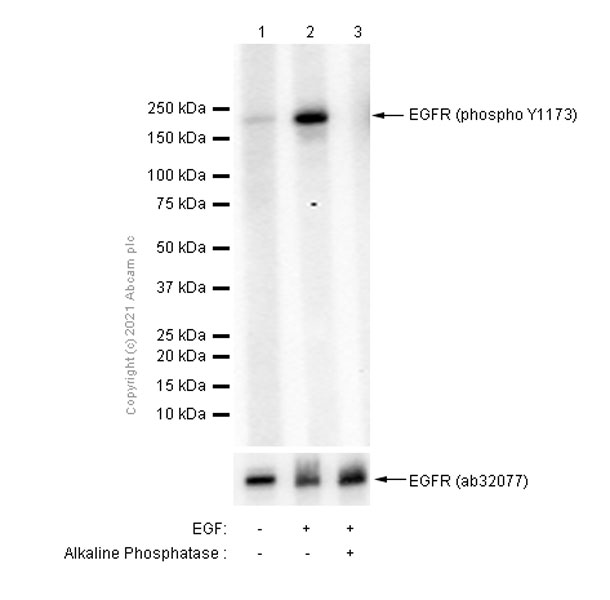 Western blot - Anti-EGFR (phospho Y1173) antibody [E124] (AB32578), expandable thumbnail