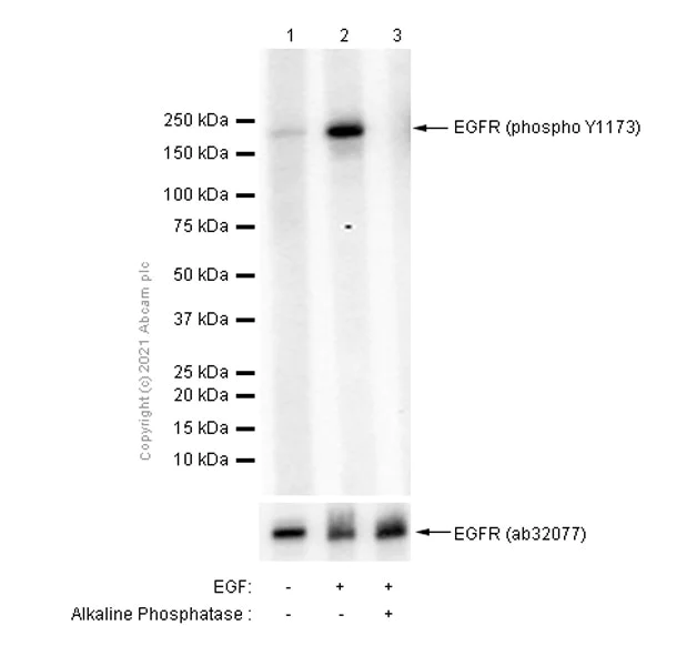 Western blot - Anti-EGFR (phospho Y1173) antibody [E124] - BSA and Azide free (AB203559)