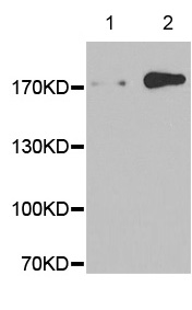 Western blot - Anti-EGFR (phospho Y845) antibody (AB194756)