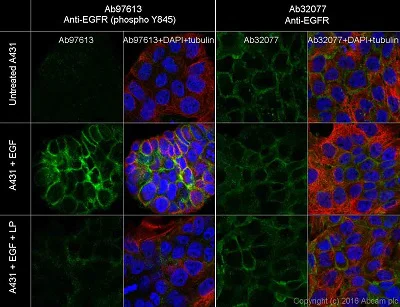 Immunocytochemistry/ Immunofluorescence - Anti-EGFR (phospho Y845) antibody [EPR2149Y] (AB97613)