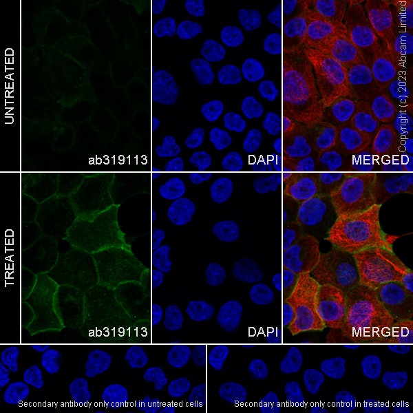 Immunocytochemistry/ Immunofluorescence - Anti-EGFR (phospho Y845 + Y1068 + Y1086) antibody [RM1132] - BSA and Azide free (AB319114), expandable thumbnail
