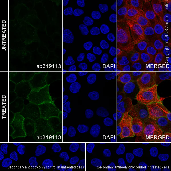 Immunocytochemistry/ Immunofluorescence - Anti-EGFR (phospho Y845 + Y1068 + Y1086) antibody [RM1132] - BSA and Azide free (AB319114)