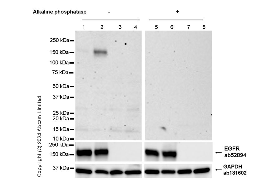 Western blot - Anti-EGFR (phospho Y845 + Y1068 + Y1086) antibody [RM1132] - BSA and Azide free (AB319114), expandable thumbnail