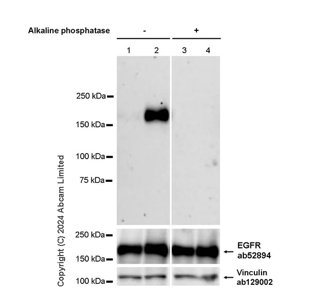 Western blot - Anti-EGFR (phospho Y845 + Y1068 + Y1086) antibody [RM1132] - BSA and Azide free (AB319114)