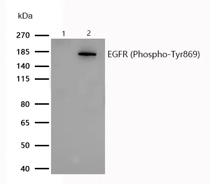 Western blot - Anti-EGFR (phospho Y869) antibody [SR1249] (AB326673)