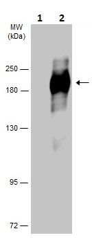 Western blot - Anti-EGFR (phospho Y974) antibody (AB226993), expandable thumbnail