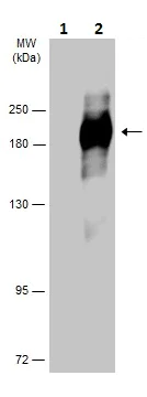 Western blot - Anti-EGFR (phospho Y974) antibody (AB226993)