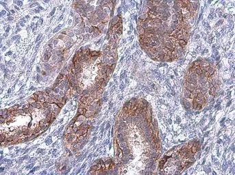 Immunohistochemistry (Formalin/PFA-fixed paraffin-embedded sections) - Anti-EGFR (phospho Y974) antibody (AB227023)