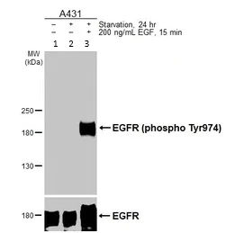 Western blot - Anti-EGFR (phospho Y974) antibody (AB227023)