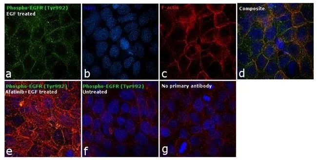 Immunocytochemistry - Anti-EGFR (phospho Y992) antibody (AB5638)