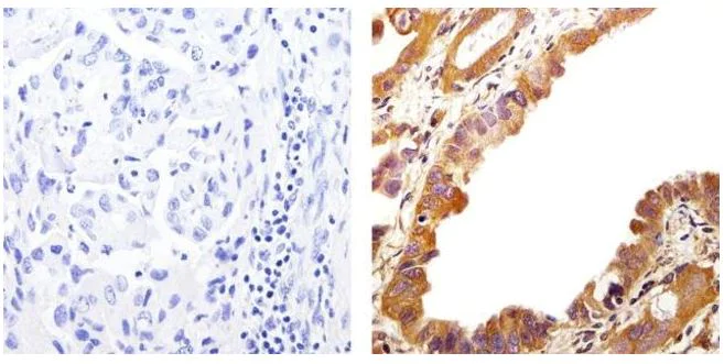 Immunohistochemistry (Formalin/PFA-fixed paraffin-embedded sections) - Anti-EGFR (phospho Y992) antibody (AB5638)