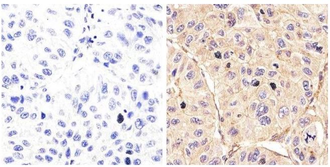 Immunohistochemistry (Formalin/PFA-fixed paraffin-embedded sections) - Anti-EGFR (phospho Y992) antibody (AB5638)