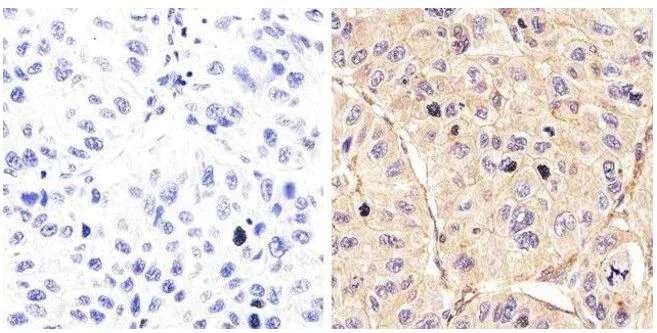 Immunohistochemistry (Formalin/PFA-fixed paraffin-embedded sections) - Anti-EGFR (phospho Y992) antibody (AB5638)
