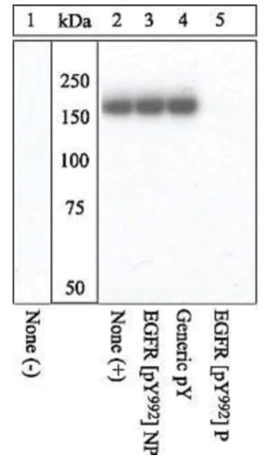 Western blot - Anti-EGFR (phospho Y992) antibody (AB5638)