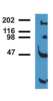Immunoprecipitation - Anti-EGFR (phospho Y992) antibody [EM-12] (AB81440)