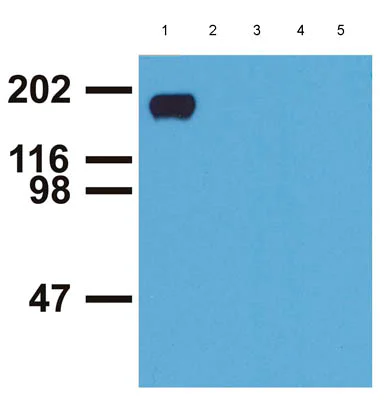 Western blot - Anti-EGFR (phospho Y992) antibody [EM-12] (AB81440)