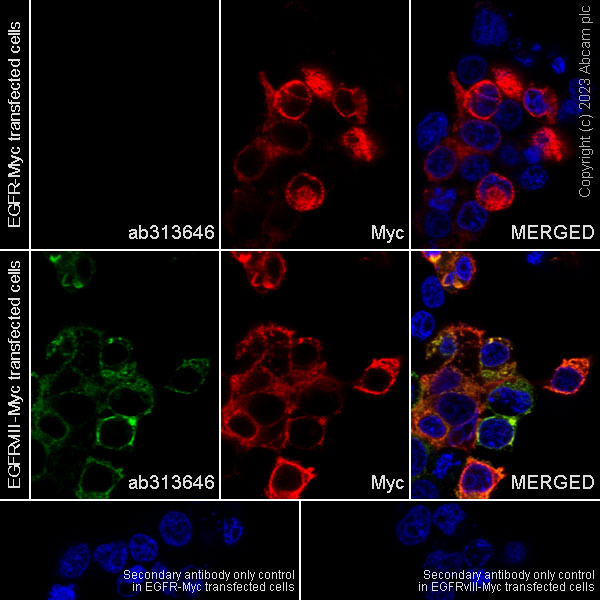 Immunocytochemistry/ Immunofluorescence - Anti-EGFRvIII antibody [EPR28380-83] (AB313646), expandable thumbnail