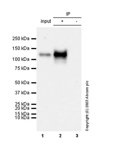 Immunoprecipitation - Anti-EGFRvIII antibody [EPR28380-83] (AB313646), expandable thumbnail