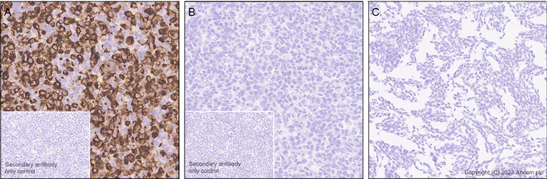 Immunohistochemistry (Formalin/PFA-fixed paraffin-embedded sections) - Anti-EGFRvIII antibody [EPR28380-83] - BSA and Azide free (AB313647)