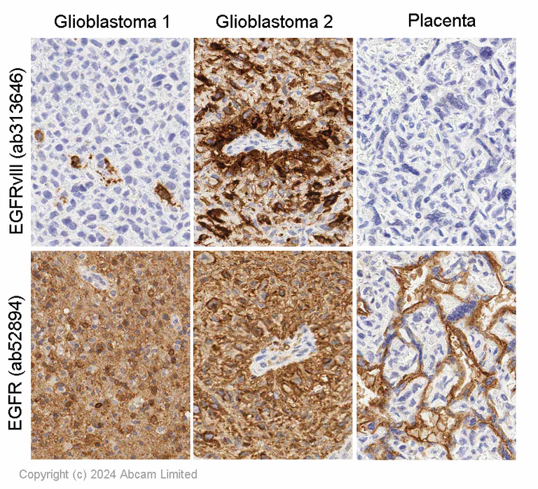 Immunohistochemistry (Formalin/PFA-fixed paraffin-embedded sections) - Anti-EGFRvIII antibody [EPR28380-83] - BSA and Azide free (AB313647)