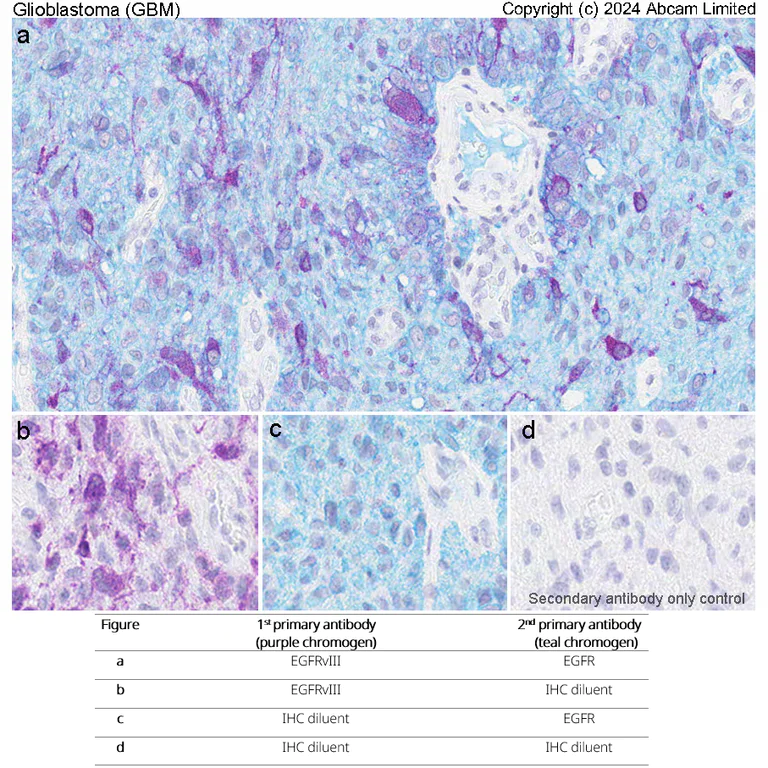 Immunohistochemistry (Formalin/PFA-fixed paraffin-embedded sections) - Anti-EGFRvIII antibody [EPR28380-83] - BSA and Azide free (AB313647)