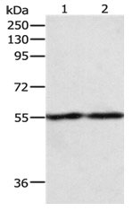 Western blot - Anti-Egr1 antibody (AB182624), expandable thumbnail