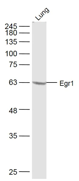 Western blot - Anti-Egr1 antibody (AB216964)