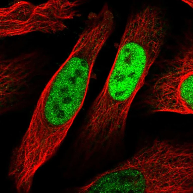 Immunocytochemistry/ Immunofluorescence - Anti-EGR1 Antibody (AB327218)