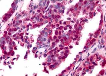 Immunohistochemistry (Formalin/PFA-fixed paraffin-embedded sections) - Anti-Egr1 antibody (AB6054)