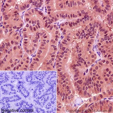 Immunohistochemistry (Formalin/PFA-fixed paraffin-embedded sections) - Anti-Egr1 antibody [EPR15916] (AB194357)