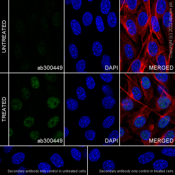 Immunocytochemistry/ Immunofluorescence - Anti-Egr1 antibody [EPR23981-46] (BSA and Azide free) (ab300450), expandable thumbnail