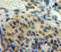 Immunohistochemistry (Formalin/PFA-fixed paraffin-embedded sections) - Anti-EGR2 antibody (AB232695)