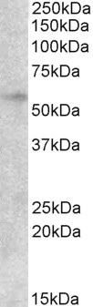Western blot - Anti-EGR2 antibody (AB63943)