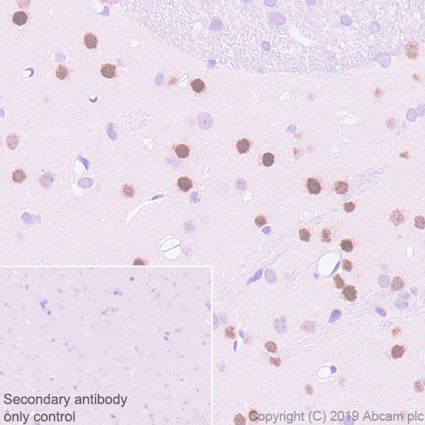 Immunohistochemistry (Formalin/PFA-fixed paraffin-embedded sections) - Anti-EGR2 antibody [EPR23228-40] (AB245228)