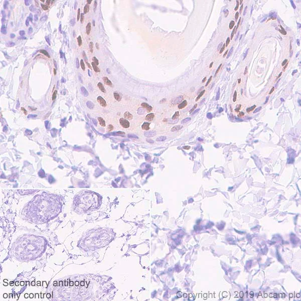 Immunohistochemistry (Formalin/PFA-fixed paraffin-embedded sections) - Anti-EGR2 antibody [EPR23228-40] (AB245228)