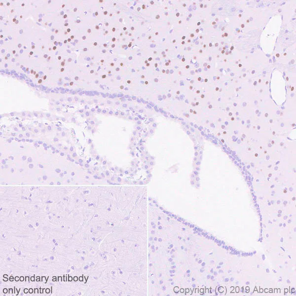 Immunohistochemistry (Formalin/PFA-fixed paraffin-embedded sections) - Anti-EGR2 antibody [EPR23228-40] (AB245228)