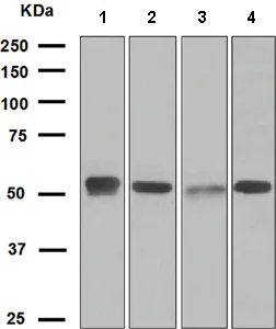 Western blot - Anti-EGR2 antibody [EPR4004] (AB108399)