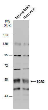 Western blot - Anti-EGR3 antibody (AB272903), expandable thumbnail