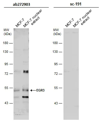 Western blot - Anti-EGR3 antibody (AB272903)