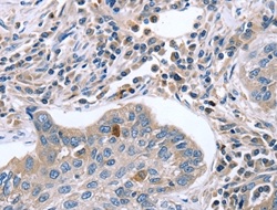 Immunohistochemistry (Formalin/PFA-fixed paraffin-embedded sections) - Anti-EGR4 antibody (AB198197), expandable thumbnail