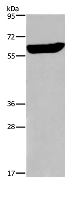 Western blot - Anti-EGR4 antibody (AB198197), expandable thumbnail