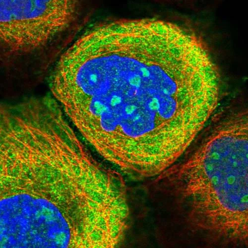 Immunocytochemistry/ Immunofluorescence - Anti-EHBP1L1 antibody (AB122557)
