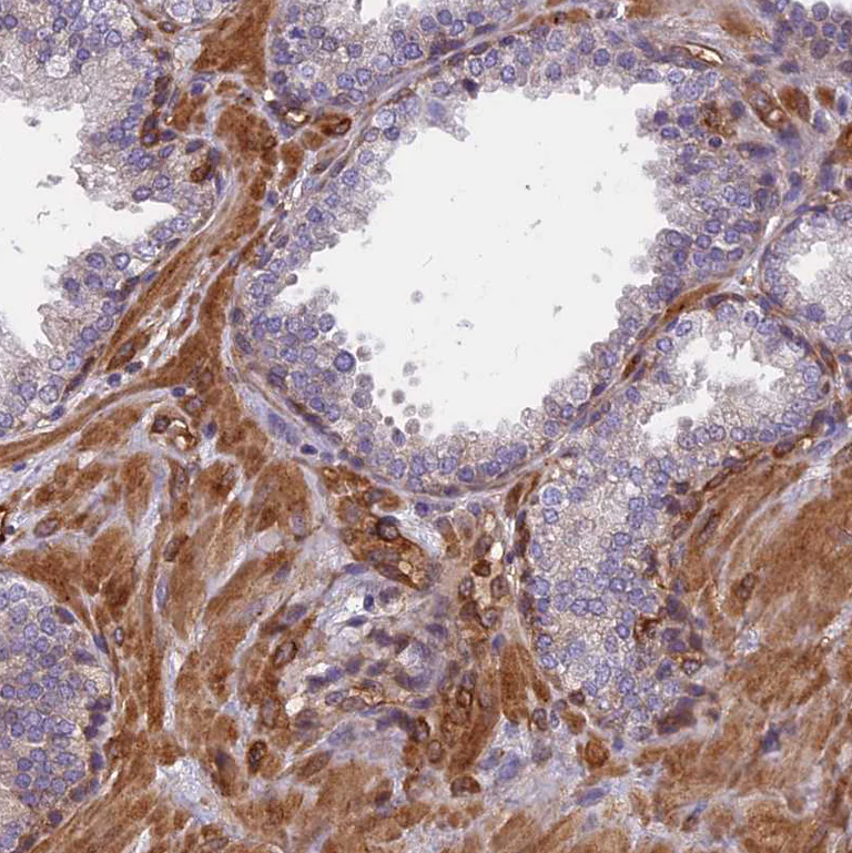 Immunohistochemistry (Formalin/PFA-fixed paraffin-embedded sections) - Anti-EHBP1L1 antibody (AB122557)