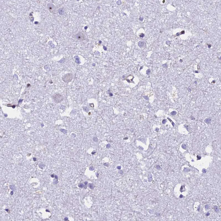 Immunohistochemistry (Formalin/PFA-fixed paraffin-embedded sections) - Anti-EHBP1L1 antibody (AB122557)