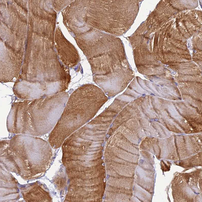 Immunohistochemistry (Formalin/PFA-fixed paraffin-embedded sections) - Anti-EHBP1L1 antibody (AB122557)