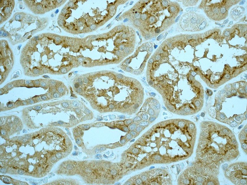 Immunohistochemistry (Formalin/PFA-fixed paraffin-embedded sections) - Anti-EHD1 antibody [EPR4954] (AB109311)
