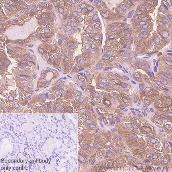 Immunohistochemistry (Formalin/PFA-fixed paraffin-embedded sections) - Anti-EHD1 antibody [EPR4954] (AB109311)