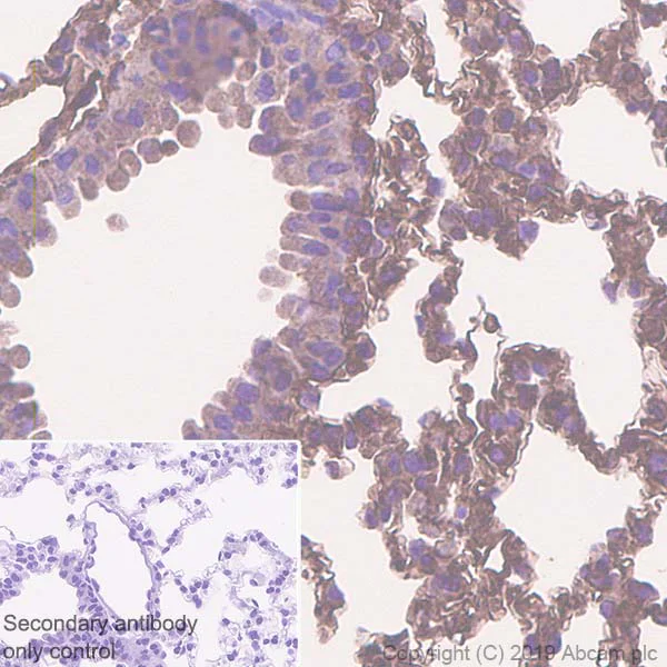 Immunohistochemistry (Formalin/PFA-fixed paraffin-embedded sections) - Anti-EHD1 antibody [EPR4954] (AB109311)